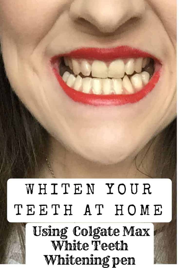 colgate teeth whitening pen