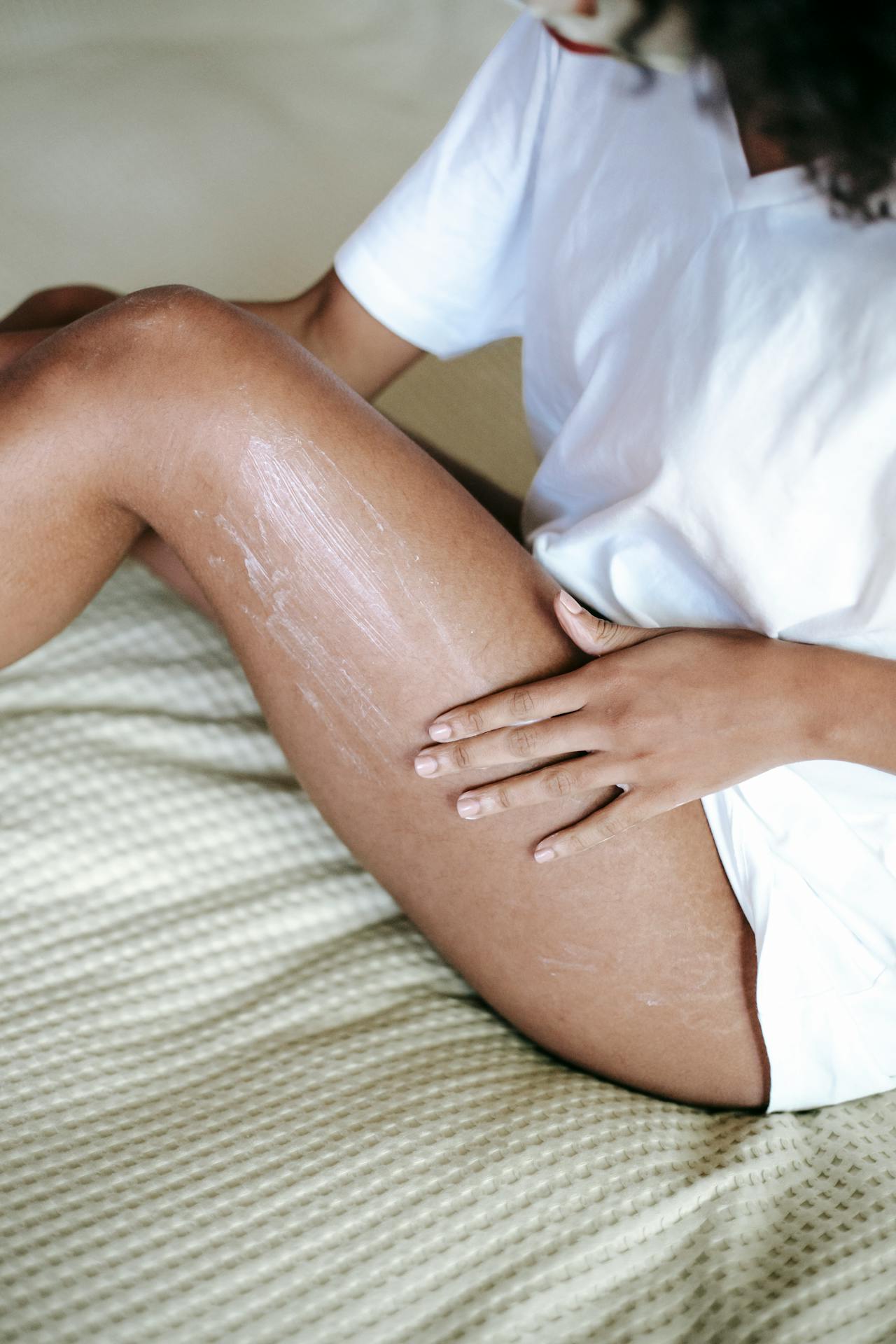 treat scars and stretchmarks